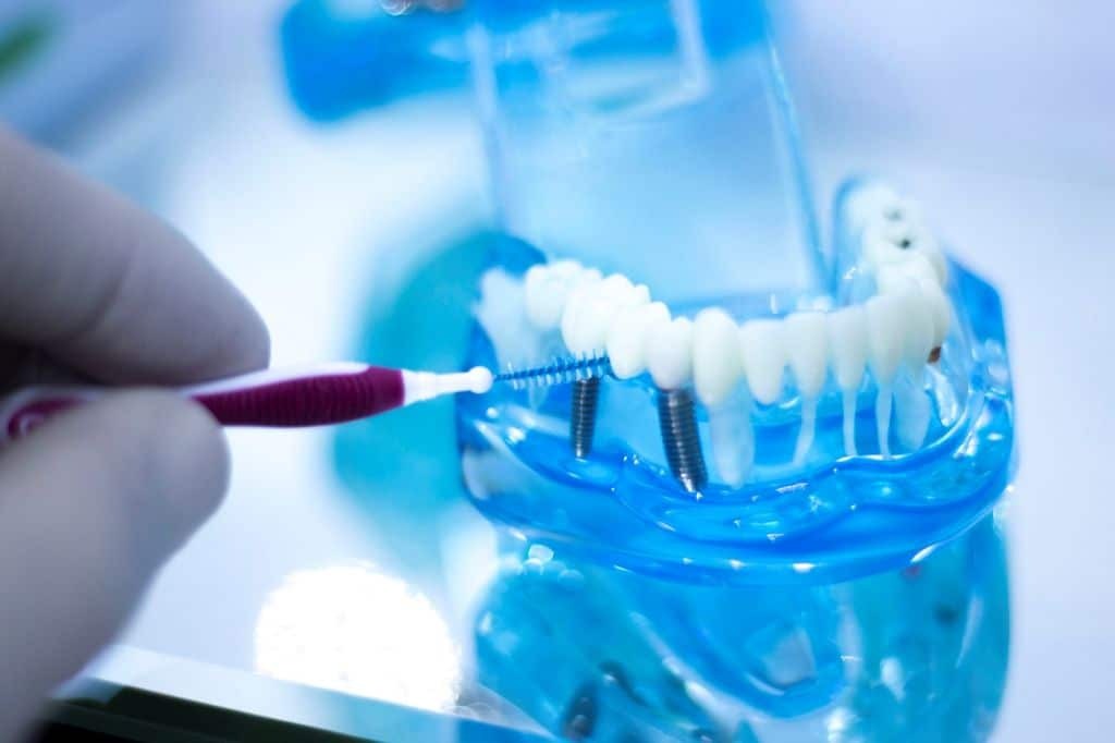 Tips for Proper Dental Implant Care and Maintenance